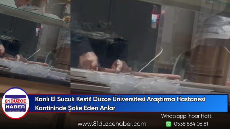 Kanlı El Sucuk Kesti! Düzce Üniversitesi Araştırma Hastanesi Kantininde Şoke Eden Anlar